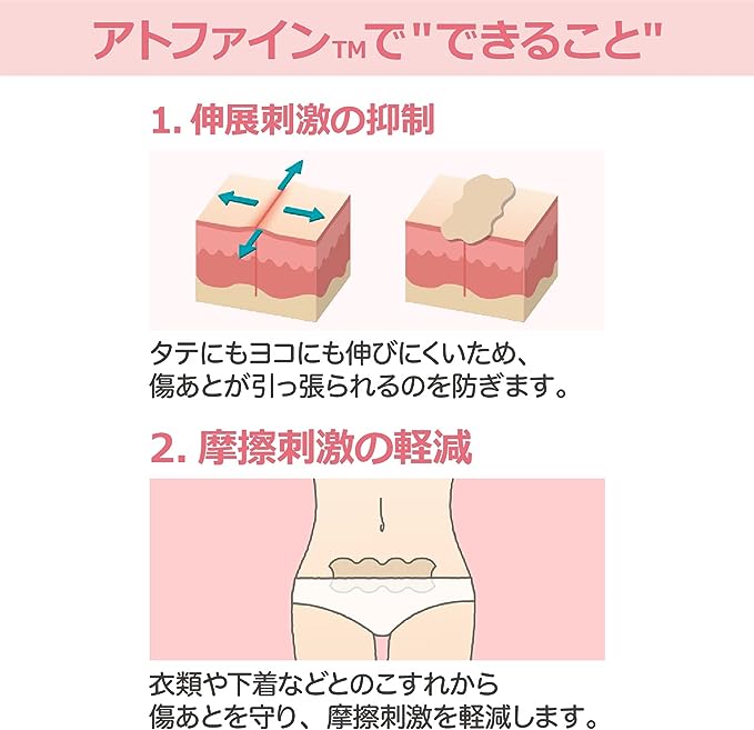 Atwine Small Size 12 My Scar Care Tape, Post-Surgical Scar Care (Compatible Scar Size: 0.4 - 1.6 inches (1 - 4 cm)) - NewNest Australia