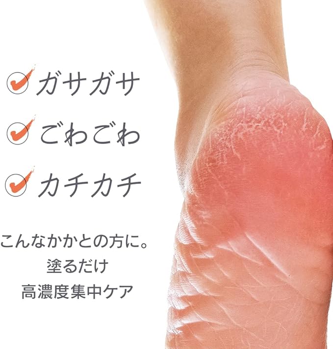 Kakatrine Moist Lotion EX Heel, Horny Care, Moisturizing, Elbow, Knee, Cracked, Moist and Won't Shave, 2.4 fl oz (70 ml) x 2 Piece Set - NewNest Australia