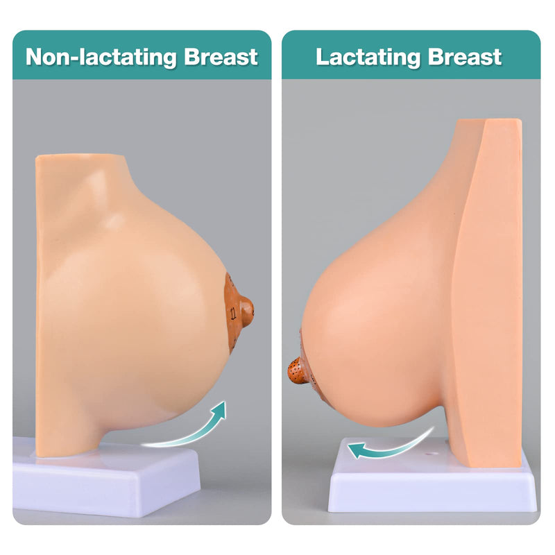 Ultrassist Non-Lactating Breast Model, Human Anatomy Model， Breast Anatomical Model with Study Card for Doctor Surgeon Gift Non-Lactating Breast Sagittal Section Model