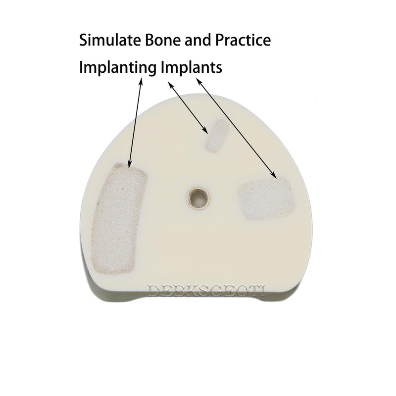 Dental Implant Typodont Practice Teeth Model Lower Jaw Overdenture Soft Gingiva Restoration Demo for Study Teach (M2004)