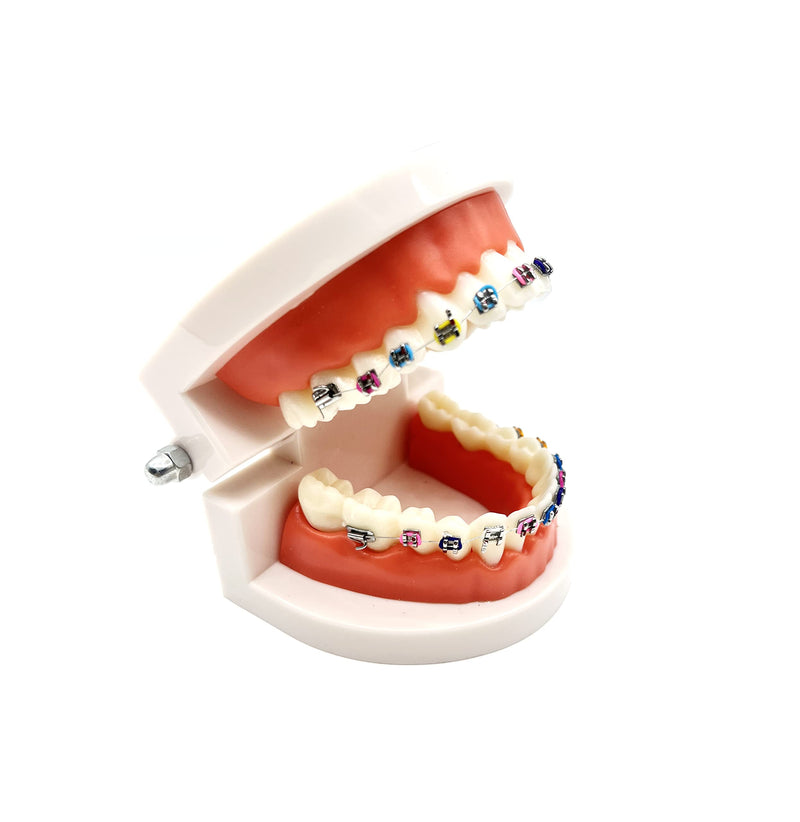 Dental Orthodontic Demonstration Model with Metal Bracket,Arch Wire Standard Teeth Model with Braces (Brackets) Brackets