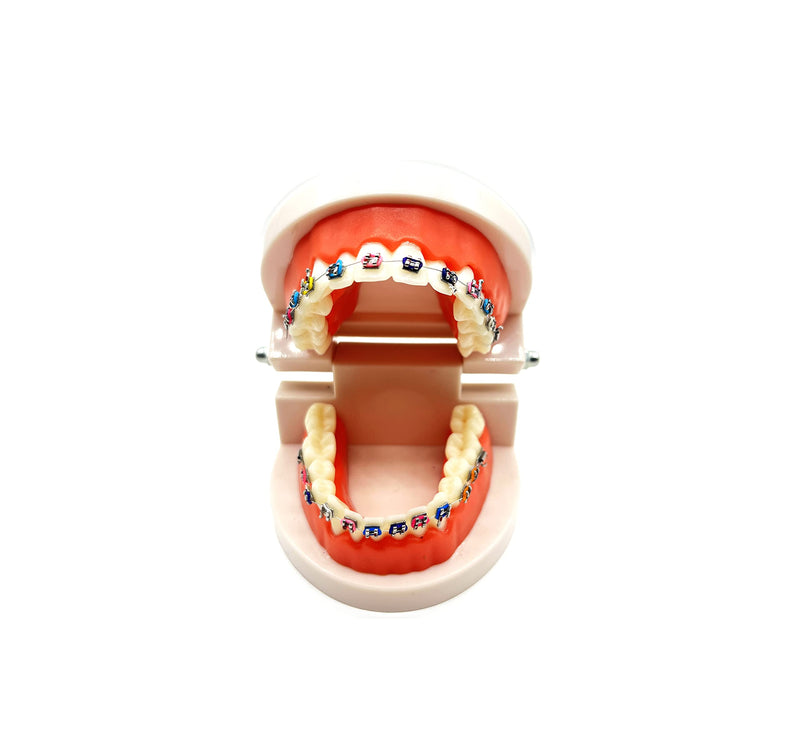 Dental Orthodontic Demonstration Model with Metal Bracket,Arch Wire Standard Teeth Model with Braces (Brackets) Brackets