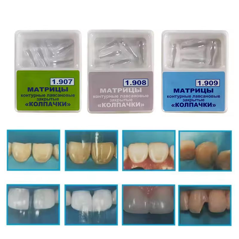 Dental Clear Matrix Anterior Matrice, BT Anterior Matrices Bioclear Style, Transparent Bow Anterior Matrices Sectional Contoured Matrix System (3, S/L/M) 3