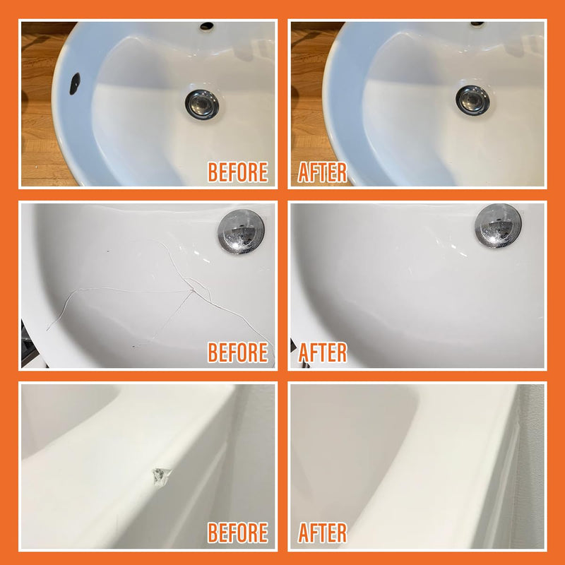 Porcelain Repair Kit White, High-Gloss Chipped Sink & Tile Repair Kit to Quickly Fix Sinks Chips and Tile Cracks with High Bond Strength, Porcelain Sink Repair Kit for Tub, Tiles, Sinks and Toilet No.01 White