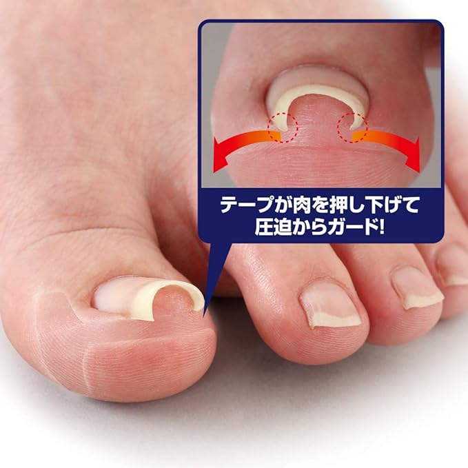 Cyprus Transparent Wrap Nail Tape, Thin Transparent Plate, Double Layered Construction, Transparent Tape, Not Conspicuous, Miene - NewNest Australia