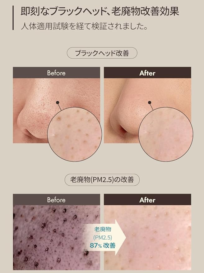 0BgE (Object) [Genuine] Blackhead Scrub Balm, Exfoliating Care, Blackhead Removal, Pore Reduction, Trilacic Moisturizing Care, Skin Calming & Moisturizing Effect, Hypoallergenic Blackhead Care, - NewNest Australia
