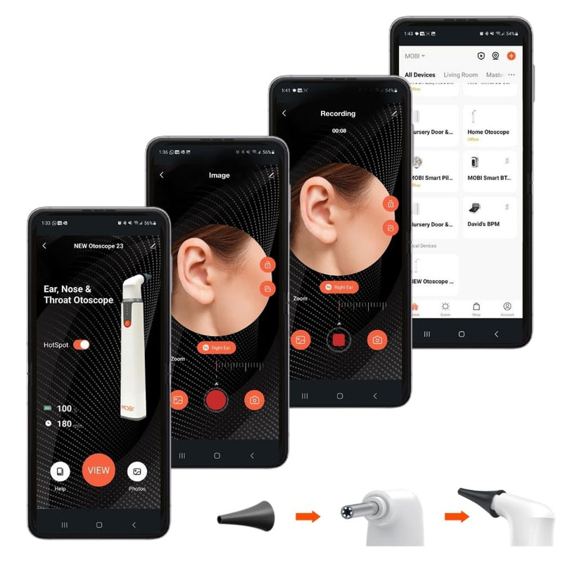 10-Piece Speculum Set for Use with MOBI Smart Bluetooth Otoscope - Professional Grade Accessories for Ear, Nose, and Throat Examination