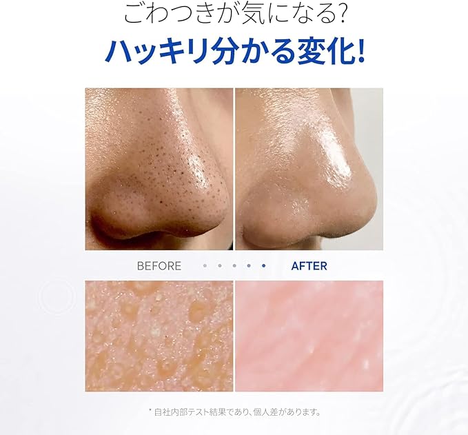 One-day's You PZ SSOC No More Blackhead Removal Pore Clean Duo, 3.4 fl oz (100 ml), Korean Cosmetics, Sebum Care, Blackheads, PZ SSOC SSOC NO MORE BLACKHEAD - NewNest Australia