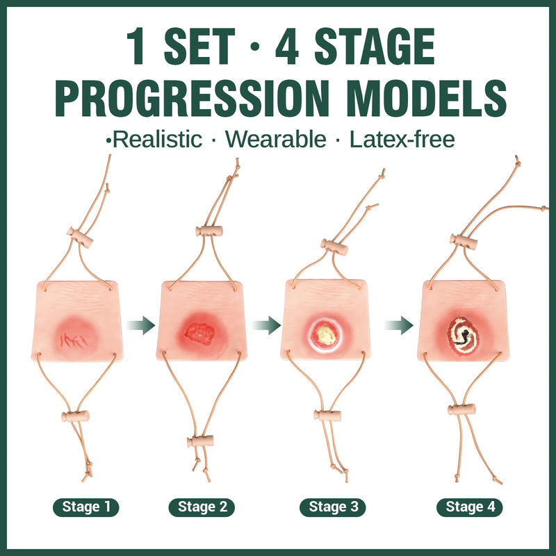 Wearable Heel Ulcer Simulation Models, 4 Stages | Pressure Injury Models, Silicone Wound Care Teaching Aid for Nursing Skills Labs, Clinical Education, Caregiver Training