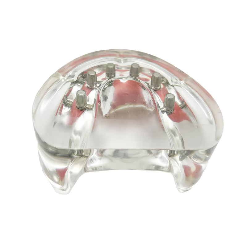 Dental Overdenture Inferior Model, 6 Nail Dental Implant Model Removable Demo Model for Researching Medical Dentist Teaching Studying