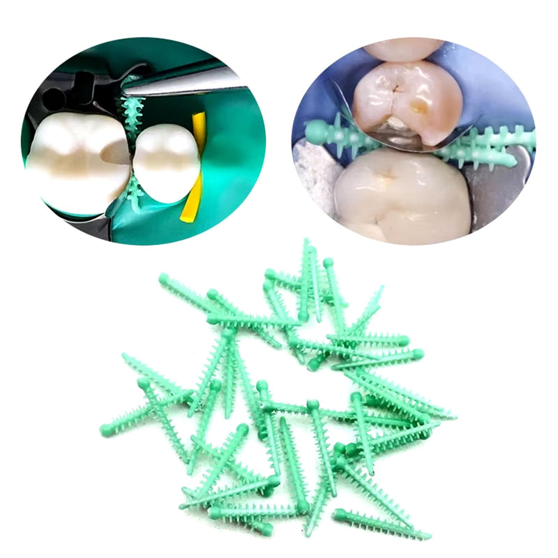 185pcs Dental Matrix Wedges Kit Interdental Wedge/Adaptive Teeth Gap Wedge/Tulwar/Diamond/Wedges Knife Wedge Guard for Tooth Restoration