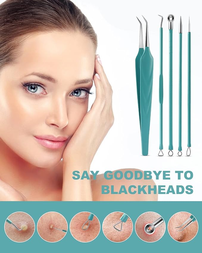 BEZOX Blackhead Removal Tool Kit - Acne Needle and Tweezers Pore Removal Tool for Acne, Spots, Comedones, Whiteheads Removal - Facial Tools 5 Pieces - NewNest Australia