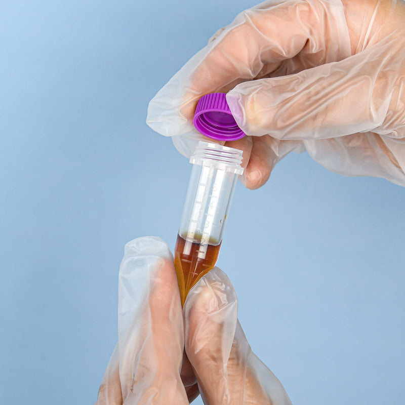 LABALPHA Conical Centrifuge Tubes 5ml with Screw Caps, Polypropylene Centrifuge Tubes with Graduated and Write-on Spot,100Pcs screw cap