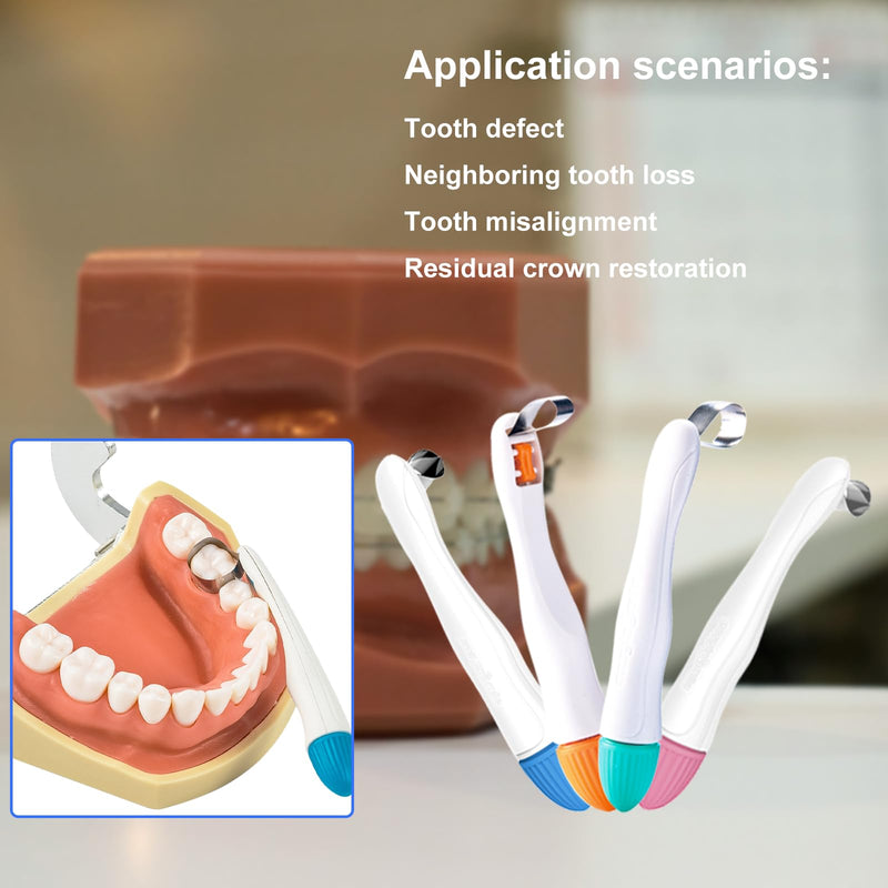 SMILEHEVENOrthodontic Dental Matrix-Profect Bands Dental Sectional Matrix System Metal Restoration Matrix Bands Yellow/Red/Blue/Green (50PCS-Blue-Standard-6mm) 50PCS-Blue-Standard-6mm