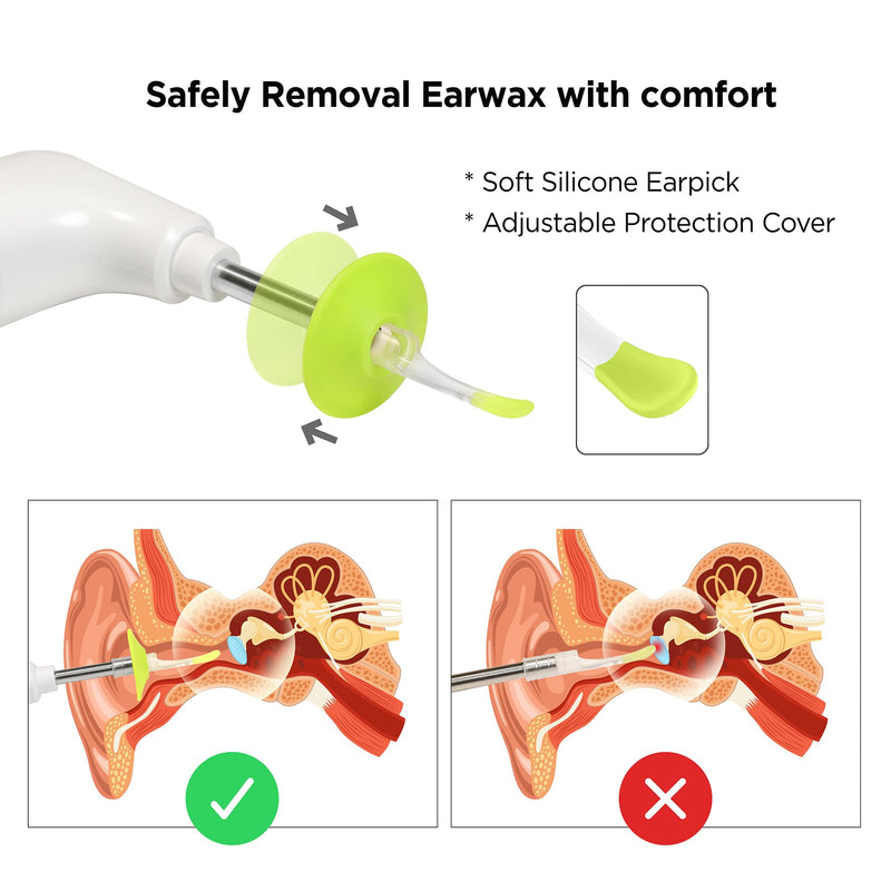 MOBI Smart Otoscope Ear Cleaning Accessory Kit - Compatible with MOBI Smart Otoscope, Ear Wax Removal Tool Convenient at-Home Ear Examinations - Ultimate Solution for Earwax Build-Up and Itchy Ears