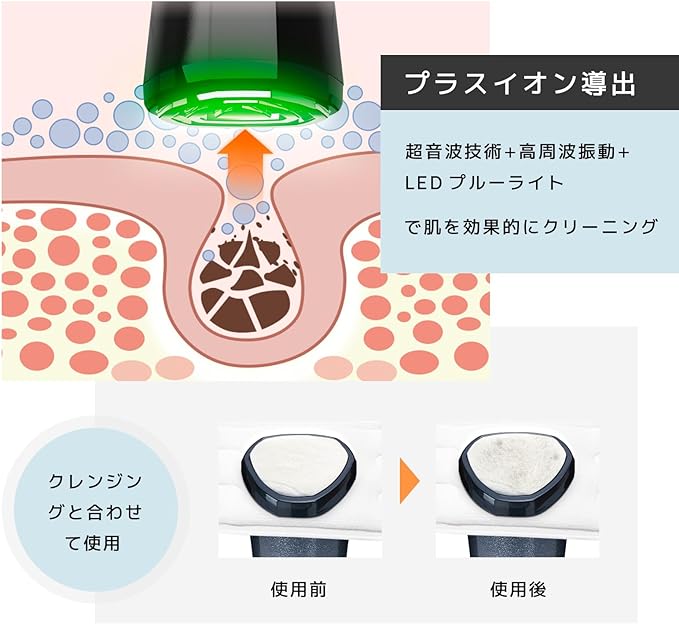 Le Dzx Facial Beauty Device, Newest Appearance, Cooling Sensation Technology, Beauty Device, Home Facial Device, RF Facial Device, EMS Micro Current, Cooling Sensation Function, Multi-functional LED, - NewNest Australia