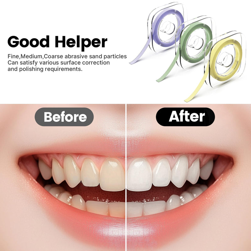 Dental Polishing Strips 3-Variant Set for Personalized Care