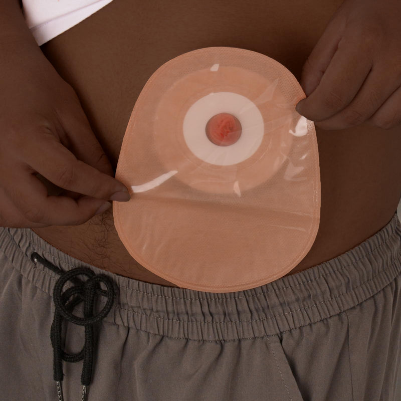 Sticky Ostomy Simulators, Stoma Training Model Set, Multi-Skin Tone Ostomy Care Practice Models for Medical Training and Patient Education - Dark