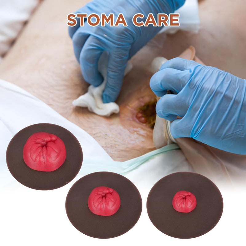 Sticky Ostomy Simulators, Stoma Training Model Set, Multi-Skin Tone Ostomy Care Practice Models for Medical Training and Patient Education - Dark
