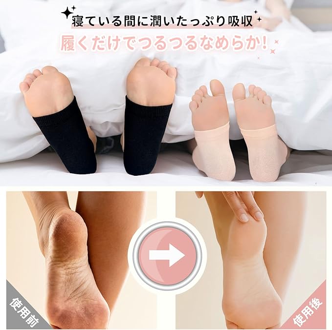 Dream Things Heel Care Socks, Set of 3, Moisturizing Gel Treatment, Exfoliating, Slippery, Cracking, Beautiful Legs for Sleeping, One Size Fits All - NewNest Australia