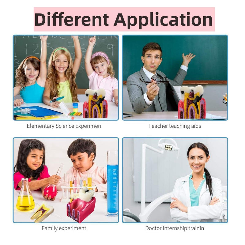 6 Times Dental Caries Model Teaching Typodont Tool for Dentists, Patients, Teachers and Students Studying and Researching (Teeth Removal) Teeth Removal