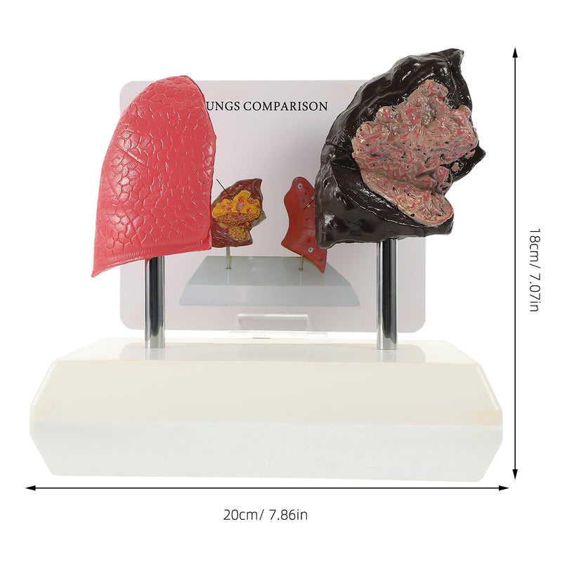 Hemoton Smoking Lung Model and Normal Lung Comparison Pulmonary Anatomy Model for Teaching 7.87X7.08X5.51 Inch Realistic Respiratory Health Education Tool