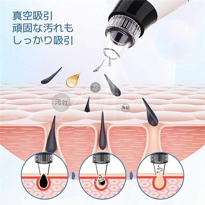 Sarlisi Pore Suction Device, Pore Care, Pore Cleaner, Facial Cleaner, Cleans, Pores, Blackheads, Pore Dirt, Cleansing, Present, Square Plug, Blackhead Care, Face Care, Skin Care, Unisex, Acne, Chin, - NewNest Australia