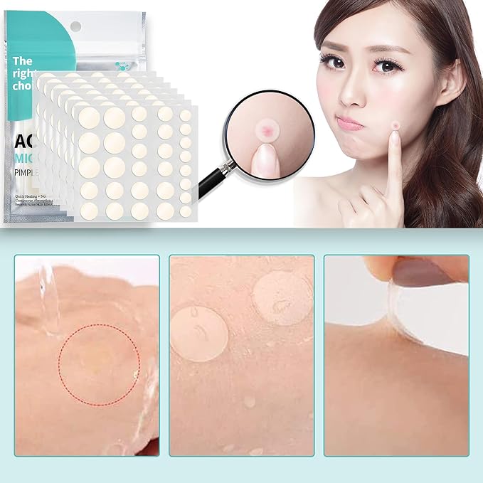 pimple patch acne pack acne patch spot patch skin care day + night use (240) - NewNest Australia