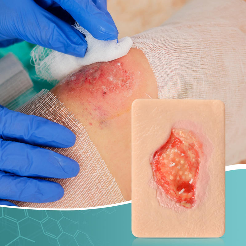 Wound Packing Trainer, Unhealthy Granulation Wound Simulation Models for Medical Education, Wound Care Demonstrations Tool
