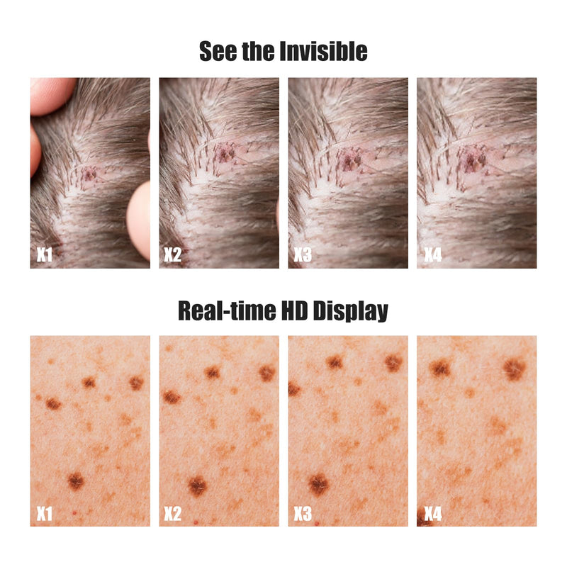 Handheld Dermatoscope, 500X Magnification Skin & Scalp Analyzer for Scalp/Hair Trichomes Facial Skin Dermatoscope, 16MP Camera for Hair Follicle Observation, Digital Microscope with 2.8" Screen