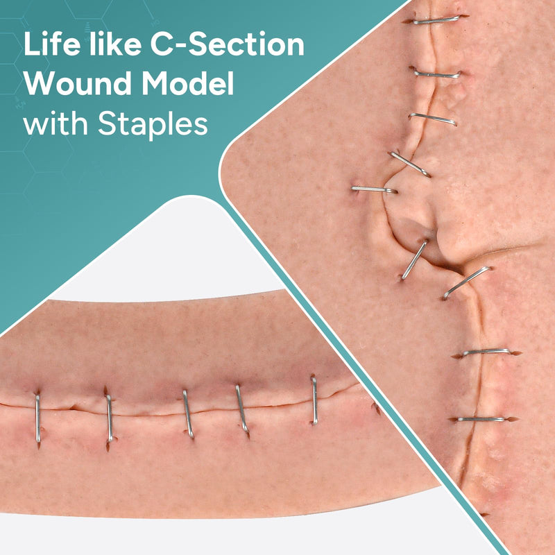 C-Section Wound Packing Trainer, Cesarean Incision Wound Simulator, Adhesive C Section Wound Care Training Model, OB/GYN Training & Patient Education Tool