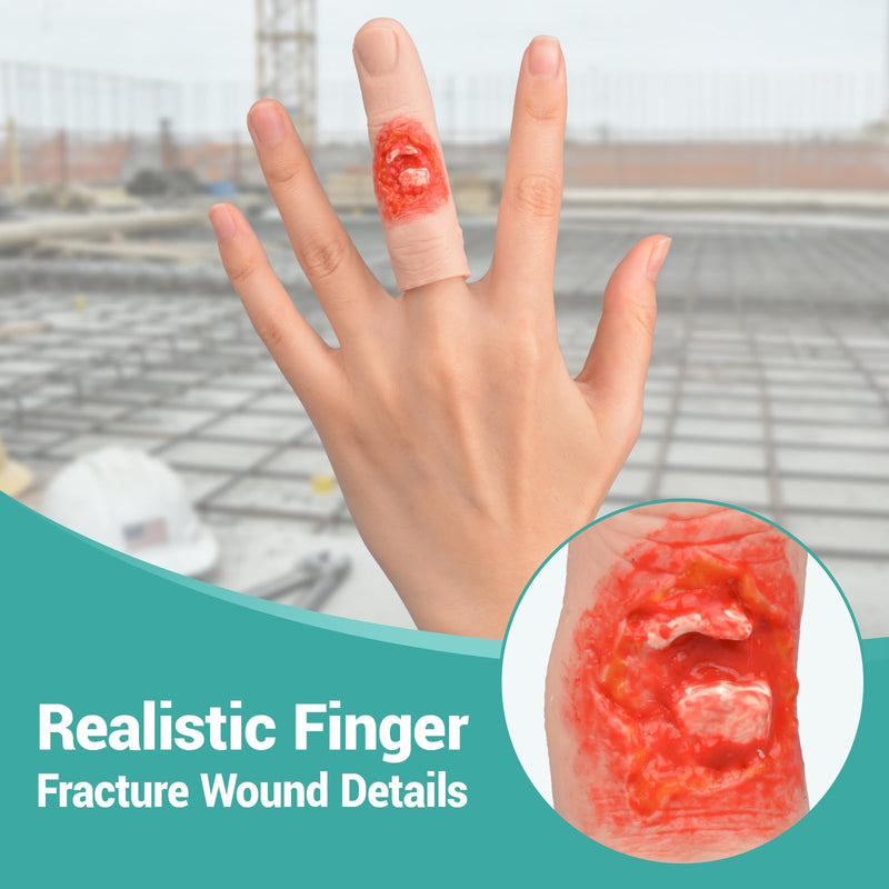 Wearable Finger Fracture Wound Trainer, Finger Injury Simulation Model with Glove, Realistic Fracture Wound Packing Trainer for First Aid & Workplace Safety Training
