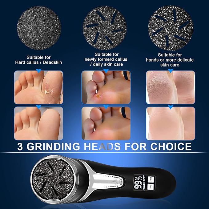 Electric Callus Remover with Vacuum Cleaner Professional Pedicure Tool Kit Rechargeable Waterproof Foot File Foot Care Dead Skin Remover 3 Heads & 2 Speeds LCD Display - NewNest Australia