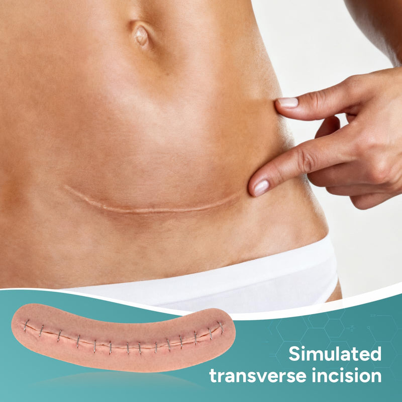 C-Section Wound Packing Trainer, Cesarean Incision Wound Simulator, Adhesive C Section Wound Care Training Model, OB/GYN Training & Patient Education Tool