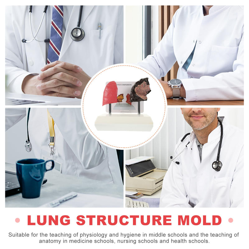 Hemoton Smoking Lung Model and Normal Lung Comparison Pulmonary Anatomy Model for Teaching 7.87X7.08X5.51 Inch Realistic Respiratory Health Education Tool