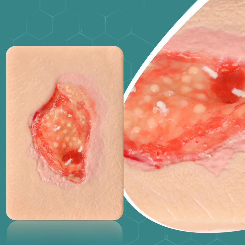 Wound Packing Trainer, Unhealthy Granulation Wound Simulation Models for Medical Education, Wound Care Demonstrations Tool