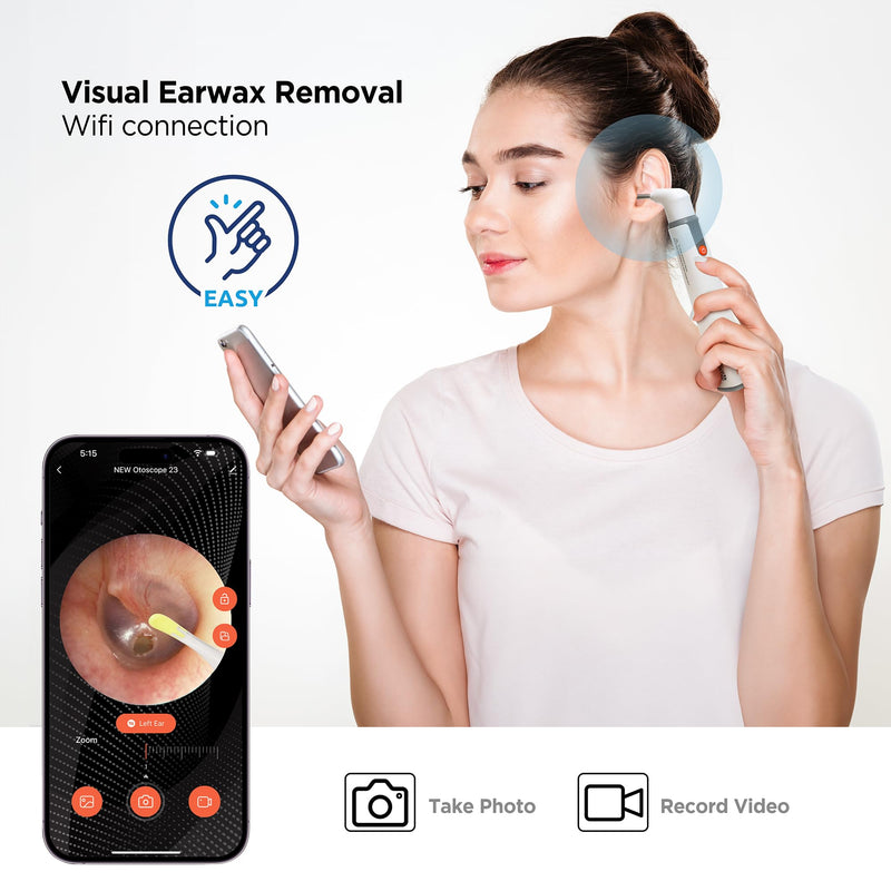 MOBI Smart Otoscope Ear Cleaning Accessory Kit - Compatible with MOBI Smart Otoscope, Ear Wax Removal Tool Convenient at-Home Ear Examinations - Ultimate Solution for Earwax Build-Up and Itchy Ears