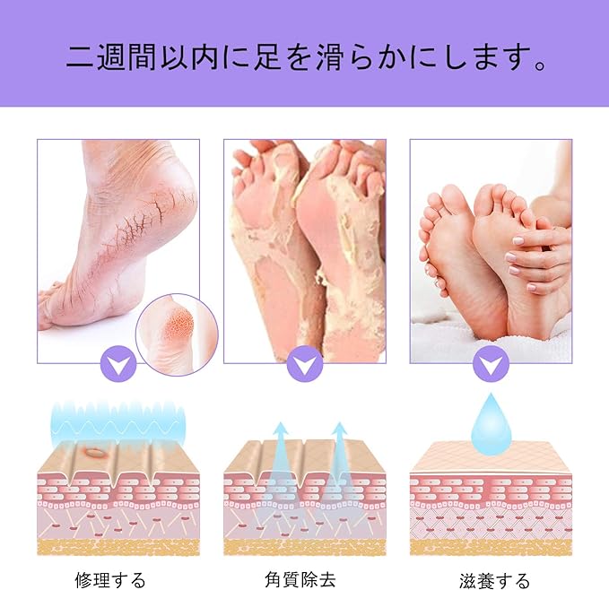 Foot Exfoliating Pack, Foot Exfoliating Pack, Foot Mask, New Packaging, Foot Exfoliating Mask, Dead Skin, Makes Feet Smooth and Beautiful, Unisex 3 Pairs - NewNest Australia