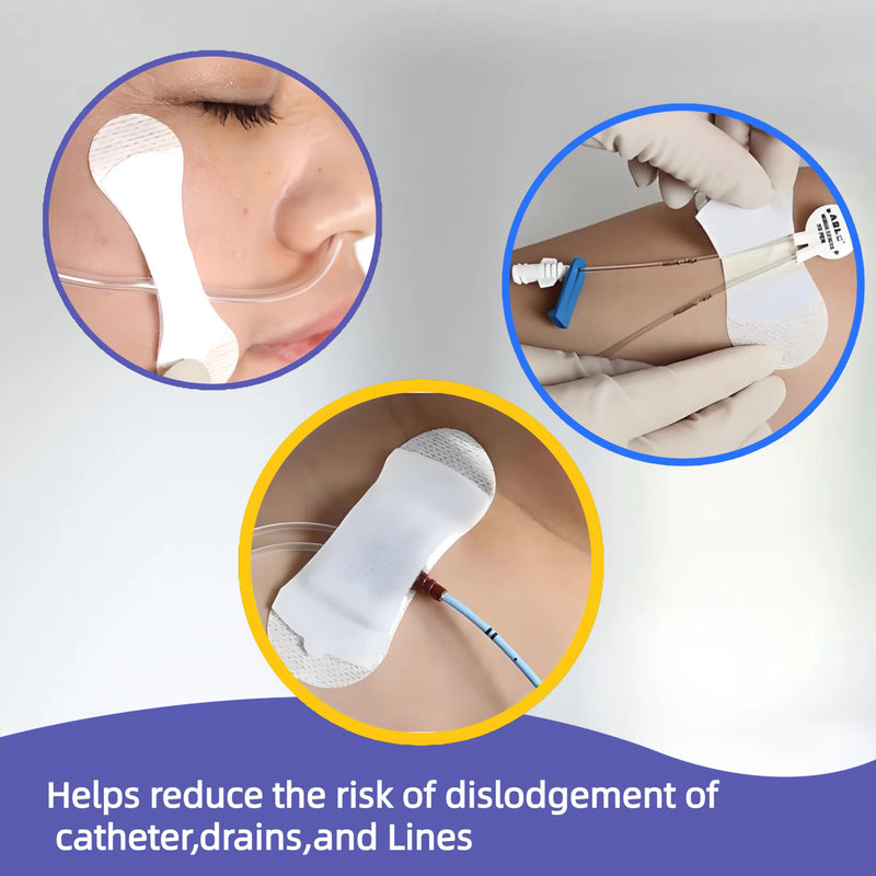 Medical Catheter Securement Device,Soft Material and Hypoallergenic Adhesive,Small Size for Catheter Securement,White, Small （Pack of 10） Small（pack of 10）