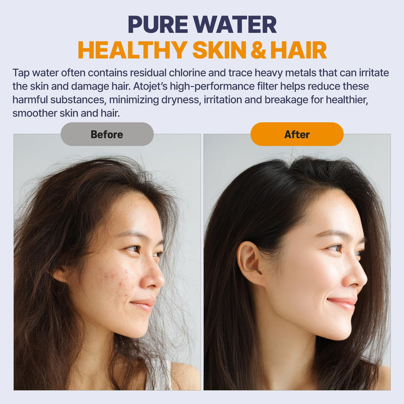 Aqua Detox Shower Filter Influenced by Korea’s Beauty Tradition - Relieves dryness and irritation while improving skin and hair health - BRUSHED NICKEL (JNE600N-SNG-DTX)