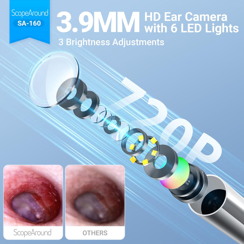 ScopeAround Digital Otoscope with IPS Screen, 720p HD Smart Visual Ear Camera, Ear Scope Otoscope Camera with 6 LED Lights, Ear Wax Removal Tool Camera, Plug & Play