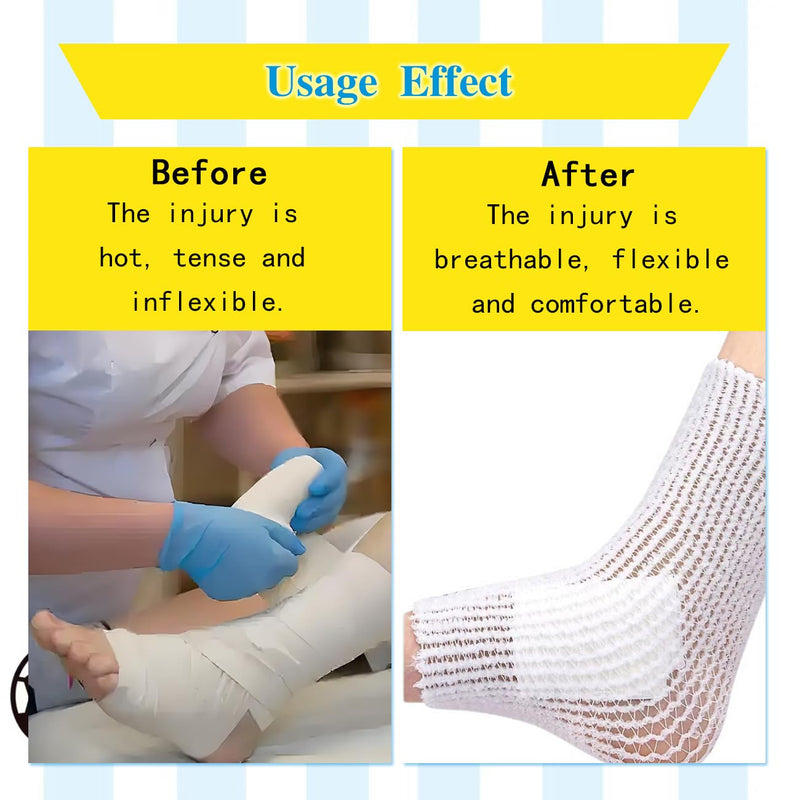 2 Roll Tubular Bandage, Stretch Dressing Retainer Tubular Webbing, Tubular Gauze Stockinette Tubing for Legs, Stretch Netting for Wound Care Without The Use of Adhesive Tape (2 Sizes) White