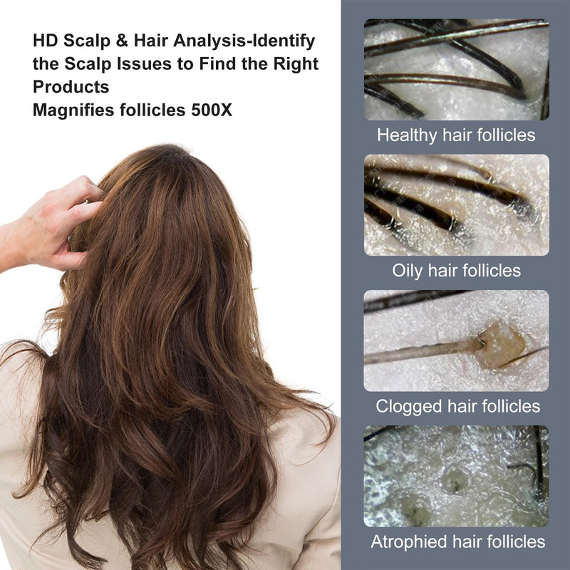 Handheld Dermatoscope, 500X Magnification Skin & Scalp Analyzer for Scalp/Hair Trichomes Facial Skin Dermatoscope, 16MP Camera for Hair Follicle Observation, Digital Microscope with 2.8" Screen