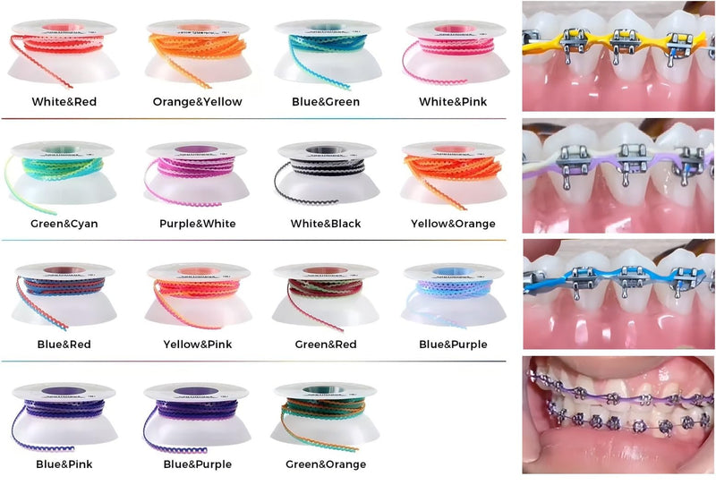 Funny Braces Power Chain Two Color Combos Dental Orthodontic Elastic Bands Power Chain 15 Feet/Roll (Purple&White, Continuous) Purple&White