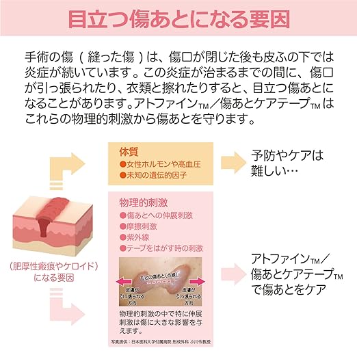 Atwine LL Size 4 My Scar Care Tape, Post-Surgical Scar Care (Compatible Scar Size: 5.9 - 7.9 inches (15 - 20 cm)) - NewNest Australia