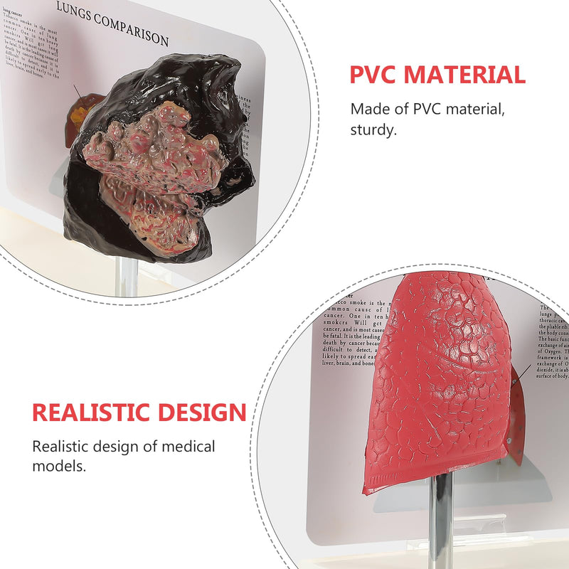 Hemoton Smoking Lung Model and Normal Lung Comparison Pulmonary Anatomy Model for Teaching 7.87X7.08X5.51 Inch Realistic Respiratory Health Education Tool