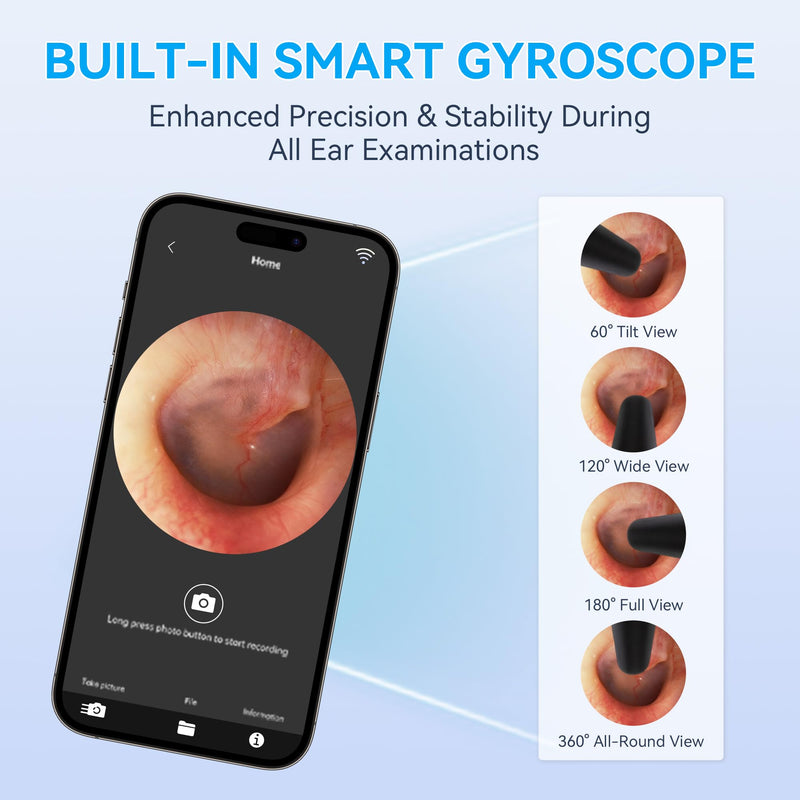 Digital Otoscope with Light, WiFi Ear Scope with 720P HD Camera, 10-Level Adjustable LED, Type-C Charging, Includes 8 Disposable Tips (4mm & 5mm)
