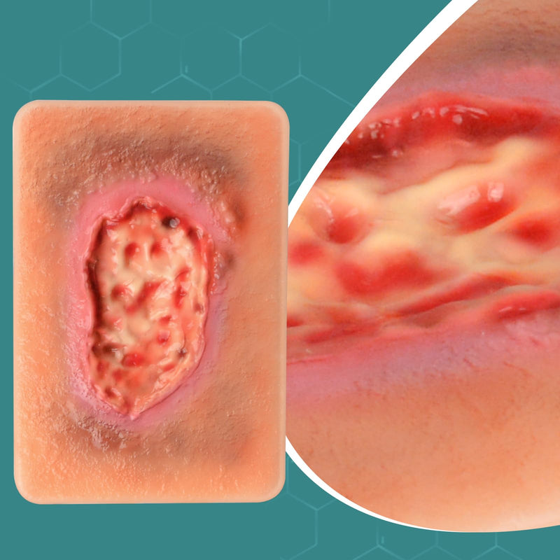 Wet Necrotic Wound Simulation Model | Wound Packing Trainer for Medical Education, Wound Care Demonstrations Tool
