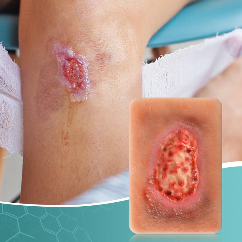 Wet Necrotic Wound Simulation Model | Wound Packing Trainer for Medical Education, Wound Care Demonstrations Tool