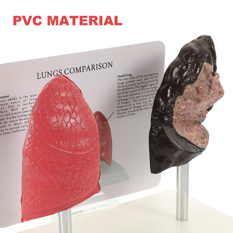 Hemoton Smoking Lung Model and Normal Lung Comparison Pulmonary Anatomy Model for Teaching 7.87X7.08X5.51 Inch Realistic Respiratory Health Education Tool